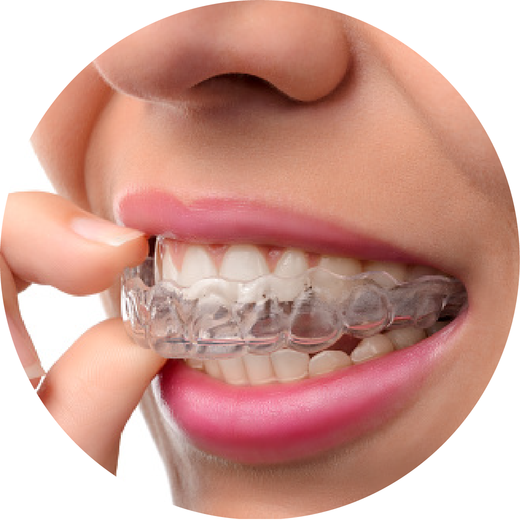 dental-braces-clear-aligners-orthodontics-cosmetic-dentistry-crown-a117c29b583aef994157f47abce9da60